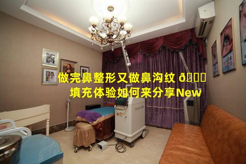 做完鼻整形又做鼻沟纹 🐎 填充体验如何来分享New